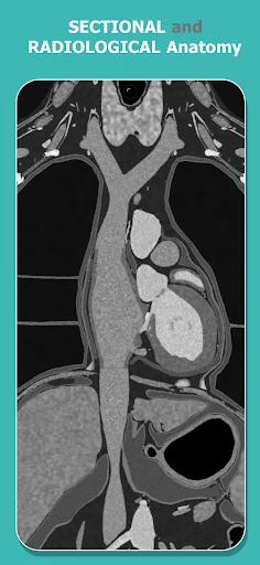 Anatomy Learning - 3D Anatomy screenshot 3